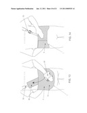 METHOD AND APPARATUS FOR THERAPEUTICALLY SUPPORTING THE ARM OF A PATIENT diagram and image