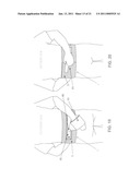 METHOD AND APPARATUS FOR THERAPEUTICALLY SUPPORTING THE ARM OF A PATIENT diagram and image