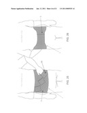 METHOD AND APPARATUS FOR THERAPEUTICALLY SUPPORTING THE ARM OF A PATIENT diagram and image