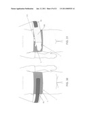 METHOD AND APPARATUS FOR THERAPEUTICALLY SUPPORTING THE ARM OF A PATIENT diagram and image