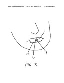 METHODS OF TREATING A DISORDER BY INHIBITING EXPIRATION diagram and image