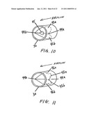 METHODS OF TREATING A DISORDER BY INHIBITING EXPIRATION diagram and image