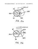 METHODS OF TREATING A DISORDER BY INHIBITING EXPIRATION diagram and image