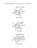 METHODS OF TREATING A DISORDER BY INHIBITING EXPIRATION diagram and image