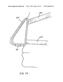 METHODS OF TREATING A DISORDER BY INHIBITING EXPIRATION diagram and image