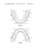 SHOCK ABSORBING DENTAL APPLIANCE diagram and image