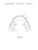 SHOCK ABSORBING DENTAL APPLIANCE diagram and image