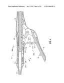 SURGICAL INSTRUMENT WITH SAFETY MECHANISM diagram and image