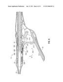 SURGICAL INSTRUMENT WITH SAFETY MECHANISM diagram and image