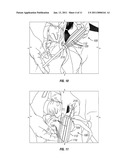 Apparatus and Method for Stowing Suspension Lines diagram and image