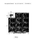 DEVICE AND PROCESS FOR MAGNETIC RESONANCE ELASTOGRAPHY (MRE) diagram and image