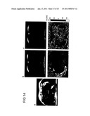 DEVICE AND PROCESS FOR MAGNETIC RESONANCE ELASTOGRAPHY (MRE) diagram and image