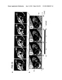 DEVICE AND PROCESS FOR MAGNETIC RESONANCE ELASTOGRAPHY (MRE) diagram and image