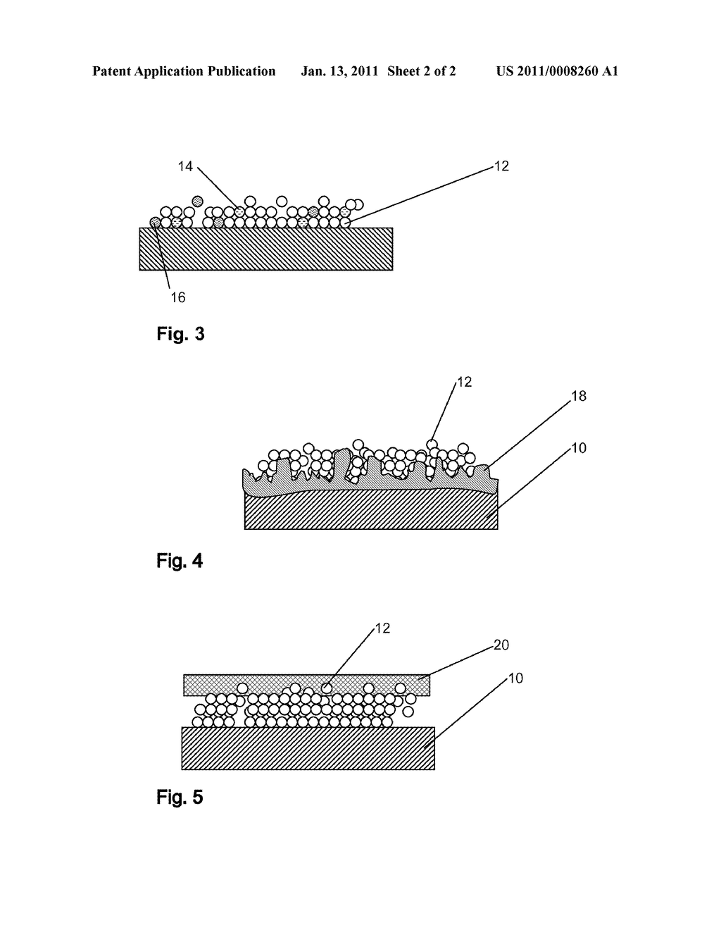 Use of Nanocrystals for Drug Delivery from a Balloon - diagram, schematic, and image 03