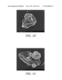 Diketopiperazine Salts for Drug Delivery and Related Methods diagram and image