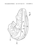 METHOD AND SYSTEM FOR DENTAL PLANNING AND PRODUCTION diagram and image