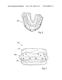 METHOD AND SYSTEM FOR DENTAL PLANNING AND PRODUCTION diagram and image