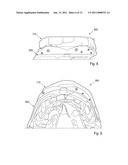 METHOD AND SYSTEM FOR DENTAL PLANNING AND PRODUCTION diagram and image