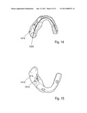 METHOD AND SYSTEM FOR DENTAL PLANNING AND PRODUCTION diagram and image