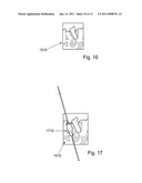 METHOD AND SYSTEM FOR DENTAL PLANNING AND PRODUCTION diagram and image