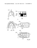 METHOD AND SYSTEM FOR DENTAL PLANNING AND PRODUCTION diagram and image