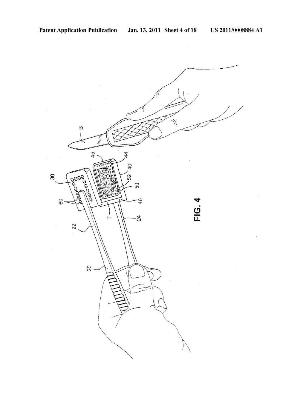 PATHOLOGY GROSSING TOOL, CASSETTE, AND BOARD - diagram, schematic, and image 05