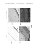 Therapeutic Treatment Of Wounds diagram and image