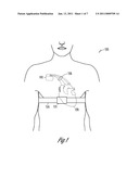 DETECTION OF CONGESTION FROM MONITORING PATIENT RESPONSE TO A RECUMBENT POSITION diagram and image
