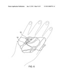 Subcutaneous access device and related methods diagram and image