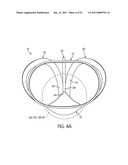 APPARATUS FOR USE WITH A PROTECTIVE CUP diagram and image