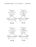 APPARATUS FOR USE WITH A PROTECTIVE CUP diagram and image