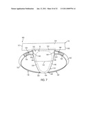 APPARATUS FOR USE WITH A PROTECTIVE CUP diagram and image