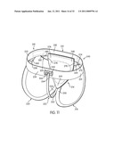 APPARATUS FOR USE WITH A PROTECTIVE CUP diagram and image