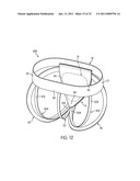 APPARATUS FOR USE WITH A PROTECTIVE CUP diagram and image