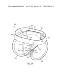 APPARATUS FOR USE WITH A PROTECTIVE CUP diagram and image