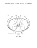 APPARATUS FOR USE WITH A PROTECTIVE CUP diagram and image