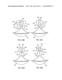 APPARATUS FOR USE WITH A PROTECTIVE CUP diagram and image