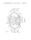 APPARATUS FOR USE WITH A PROTECTIVE CUP diagram and image