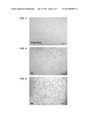 EFFECT OF RADIOFREQUENCY FIELDS ON CELL GROWTH AND METHODS FOR LAPAROSCOPIC TREATMENT diagram and image