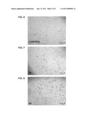 EFFECT OF RADIOFREQUENCY FIELDS ON CELL GROWTH AND METHODS FOR LAPAROSCOPIC TREATMENT diagram and image