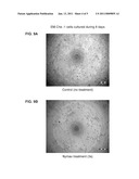 EFFECT OF RADIOFREQUENCY FIELDS ON CELL GROWTH AND METHODS FOR LAPAROSCOPIC TREATMENT diagram and image