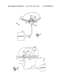 Apparatus and Method for Reducing Subcutaneous Fat Deposits, Virtual Face Lift and Body Sculpturing by Electroporation diagram and image