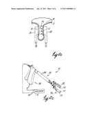 Apparatus and Method for Reducing Subcutaneous Fat Deposits, Virtual Face Lift and Body Sculpturing by Electroporation diagram and image