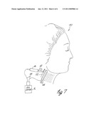 Apparatus and Method for Reducing Subcutaneous Fat Deposits, Virtual Face Lift and Body Sculpturing by Electroporation diagram and image