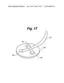 METAL VASCULAR APERTURE CLOSURE DEVICE diagram and image