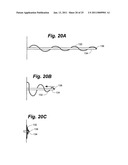 METAL VASCULAR APERTURE CLOSURE DEVICE diagram and image