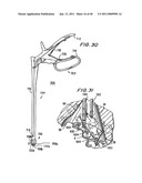 METHODS AND APPARATUSES FOR STABILIZING THE SPINE THROUGH AN ACCESS DEVICE diagram and image