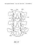 METHODS AND APPARATUSES FOR STABILIZING THE SPINE THROUGH AN ACCESS DEVICE diagram and image