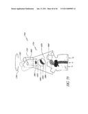 METHODS AND APPARATUSES FOR STABILIZING THE SPINE THROUGH AN ACCESS DEVICE diagram and image