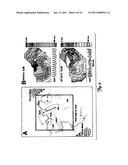 METHOD AND DEVICE FOR THREE-STAGE ATRIAL CARDIOVERSION THERAPY diagram and image